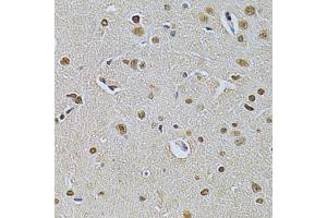 Immunohistochemistry of paraffin-embedded rat brain using ILK Antibody. (ILK 抗体  (AA 1-260))