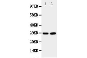 Western Blotting (WB) image for anti-Prion Protein (PRNP) (AA 143-159), (Middle Region) antibody (ABIN3044180) (PRNP 抗体  (Middle Region))