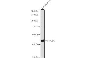 Western blot analysis of extracts of Mouse testis, using CYP11 antibody (6363) at 1:1000 dilution. (CYP11A1 抗体  (AA 40-320))
