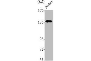 Western Blot analysis of Jurkat cells using NOS2 Polyclonal Antibody (NOS2 抗体  (C-Term))