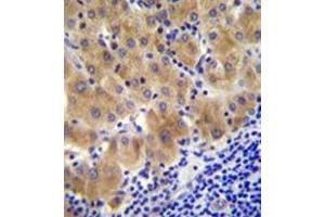 Formalin fixed and paraffin embedded human liver tissue reacted with GGH Antibody (C-term) followed by peroxidase conjugation of the secondary antibody and DAB staining. (GGH 抗体  (C-Term))