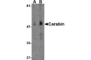 Western Blotting (WB) image for anti-TBC1 Domain Family, Member 10C (TBC1D10C) (N-Term) antibody (ABIN1031291) (Carabin 抗体  (N-Term))
