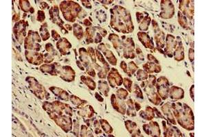 Immunohistochemistry of paraffin-embedded human pancreatic tissue using ABIN7143927 at dilution of 1:100 (Parvin alpha 抗体  (AA 2-94))