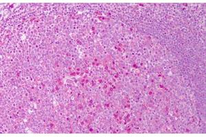 Anti-IL-6 antibody IHC staining of human tonsil.