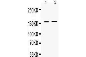Western blot analysis of TRPM4 expression in mouse spleen extract (lane 1) and SW620 whole cell lysates (lane 2). (TRPM4 抗体  (AA 1079-1214))