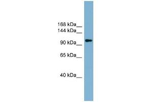 WB Suggested Anti-ACLY  Antibody Titration: 0. (ACLY 抗体  (Middle Region))
