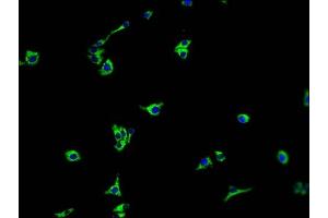Immunofluorescence staining of HepG2 cells with ABIN7140231 at 1:100, counter-stained with DAPI. (TMEM37 抗体  (AA 4-20))