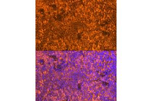 Immunofluorescence analysis of Mouse spleen using FB antibody (ABIN6129339, ABIN6140465, ABIN6140466 and ABIN6224941) at dilution of 1:100. (FAM65B 抗体  (AA 1-210))