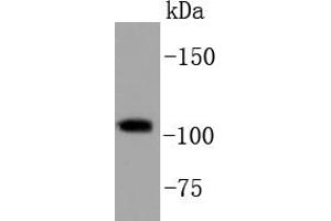 HeLa cell lysates, probed with PI3-kinase p110 subunit beta (34F12) Monoclonal Antibody  at 1:1000 overnight at 4˚C. (PIK3CB 抗体)
