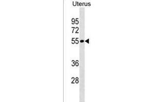 LRRIQ4 Antibody (N-term) (ABIN1538898 and ABIN2838169) western blot analysis in Uterus tissue lysates (35 μg/lane). (LRRIQ4 抗体  (N-Term))
