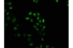 Immunofluorescence staining of Hela cells with ABIN7153753 at 1:100, counter-stained with DAPI. (SIP1 抗体  (AA 1-280))
