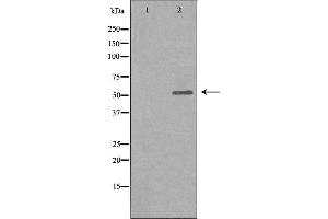 Western blot analysis of extracts from COLO205 cells, using GLR antibody. (Glucagon Receptor 抗体  (Internal Region))