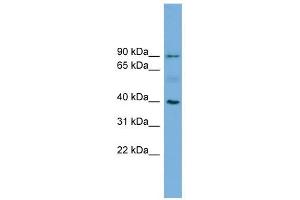 HFE antibody used at 1 ug/ml to detect target protein. (HFE 抗体  (N-Term))
