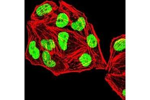 Immunofluorescence (IF) image for anti-Mismatch Repair Protein 2 (MSH2) (AA 442-586) antibody (ABIN7193508)