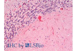 ABIN5539458 (5µg/ml) staining of paraffin embedded Human Cerebellum. (SLC7A6 抗体  (N-Term))