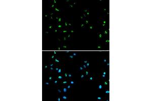 Immunofluorescence analysis of A549 cells using HDAC4 antibody (ABIN5970069). (HDAC4 抗体)