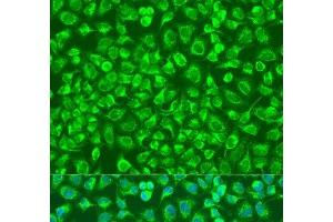 Immunofluorescence analysis of U2OS cells using ENTPD5 Polyclonal Antibody at dilution of 1:100. (ENTPD5 抗体)