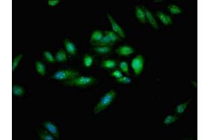 Immunofluorescent analysis of Hela cells using ABIN7174362 at dilution of 1:100 and Alexa Fluor 488-congugated AffiniPure Goat Anti-Rabbit IgG(H+L) (CYLD 抗体  (C-Term))