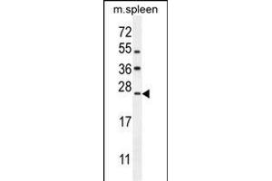 LMO4 Antibody (Center) (ABIN654714 and ABIN2844403) western blot analysis in mouse spleen tissue lysates (35 μg/lane). (LMO4 抗体  (AA 104-131))