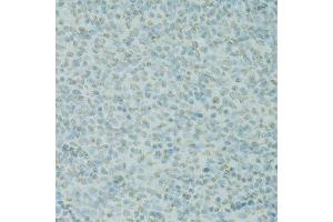 Immunohistochemistry (Paraffin-embedded Sections) (IHC (p)) image for anti-Scaffold Attachment Factor B (SAFB) (AA 1-200) antibody (ABIN6147357)