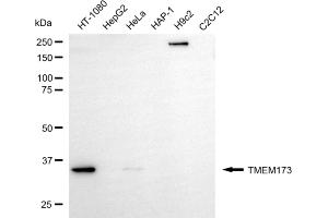 Western blotting analysis using TMEM173 antibody (ABIN7800620). (Recombinant STING/TMEM173 抗体)