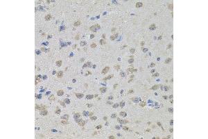 Immunohistochemistry (Paraffin-embedded Sections) (IHC (p)) image for anti-Mitogen-Activated Protein Kinase 1 (MAPK1) (AA 200-300) antibody (ABIN6143516)