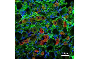 Immunostaining of a 7 μm thick DRG neuron section from a 3 month old rat labeling NaV1.