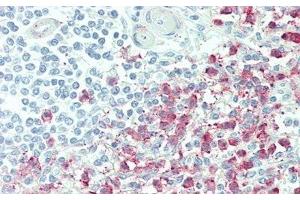 Detection of ICAM4 in Human Spleen Tissue using Polyclonal Antibody to Intercellular Adhesion Molecule 4 (ICAM4) (ICAM4 抗体  (AA 23-227))