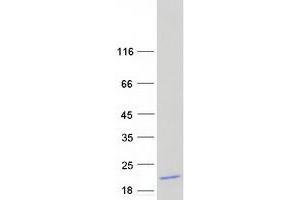 Western Blotting (WB) image for Secretory Leukocyte Peptidase Inhibitor (SLPI) protein (Myc-DYKDDDDK Tag) (ABIN2714760)