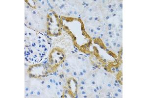 Immunohistochemistry (IHC) image for anti-Electrogenic Sodium Bicarbonate Cotransporter 4 (NBC4) (AA 1042-1121) antibody (ABIN6148015)