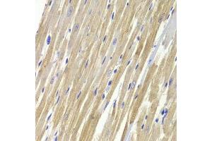 Immunohistochemistry of paraffin-embedded rat heart using GPD1 Antibody. (GPD1 抗体  (AA 1-349))
