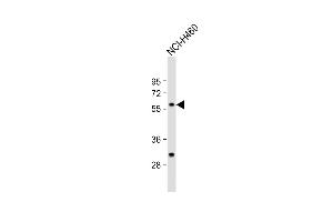 Anti-CARS2 Antibody (C-term) at 1:1000 dilution + NCI- whole cell lysate Lysates/proteins at 20 μg per lane. (CARS2 抗体  (C-Term))
