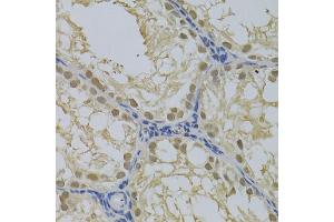 Immunohistochemistry of paraffin-embedded rat testis using DNMT3A Antibody (ABIN1872325) at dilution of 1:100 (40x lens). (DNMT3A 抗体)