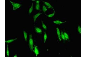 Immunofluorescence (IF) image for anti-PDS5, Regulator of Cohesion Maintenance, Homolog A (PDS5A) (AA 2-134) antibody (ABIN7169756)