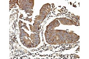 IHC analysis of TAB2 using anti-TAB2 antibody (ABIN7600244). (TAB2 抗体  (AA 169-522))