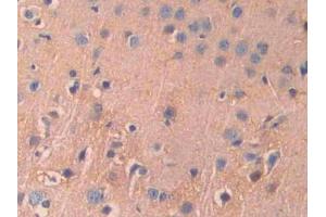 Used in DAB staining on fromalin fixed paraffin- embedded liver tissue (IL18R1 抗体  (AA 391-518))