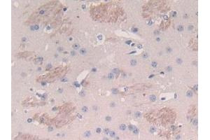 Detection of TP in Mouse Cerebrum Tissue using Polyclonal Antibody to Thymidine Phosphorylase (TP) (Thymidine Phosphorylase 抗体  (AA 29-305))