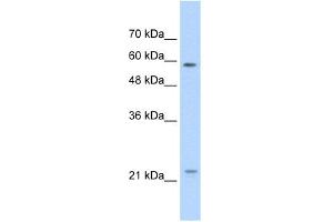 WB Suggested Anti-CAV1 Antibody Titration:  1. (Caveolin-1 抗体  (N-Term))