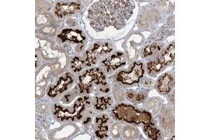 Immunohistochemical staining of human kidney with MMGT1 polyclonal antibody  shows strong membranous positivity in cells of tubules.