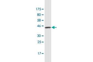 Western Blot detection against Immunogen (47. (TM4SF4 抗体  (AA 1-202))