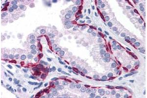 Human Prostate: Formalin-Fixed, Paraffin-Embedded (FFPE) (KRT81 抗体  (AA 1-203))