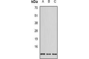 Western blot analysis of RPS20 expression in SHSY5Y (A), MCF7 (B), HEK293T (C) whole cell lysates. (RPS20 抗体)