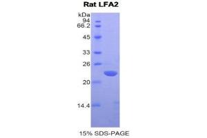 SDS-PAGE (SDS) image for CD2 (CD2) (AA 27-203) protein (His tag) (ABIN1878380) (CD2 Protein (CD2) (AA 27-203) (His tag))