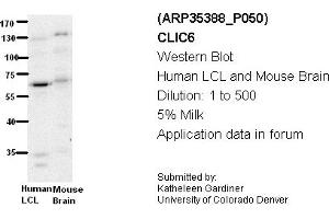 Image no. 2 for anti-Chloride Intracellular Channel 6 (CLIC6) (Middle Region) antibody (ABIN2776271) (CLIC6 抗体  (Middle Region))