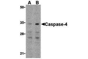 Western Blotting (WB) image for anti-Caspase 4, Apoptosis-Related Cysteine Peptidase (CASP4) (N-Term) antibody (ABIN1031297) (Caspase 4 抗体  (N-Term))