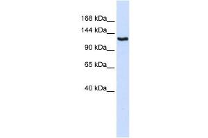 IGSF1 antibody used at 1 ug/ml to detect target protein. (IGSF1 抗体  (N-Term))