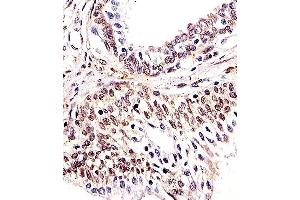Paraformaldehyde-fixed, paraffin embedded human prostate tissue, Antigen retrieval by boiling in sodium citrate buffer (pH6. (H2AFX 抗体)