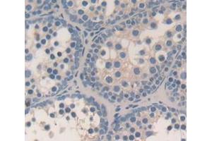 Used in DAB staining on fromalin fixed paraffin- embedded Kidney tissue (Inhibin alpha 抗体  (AA 240-366))