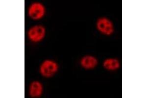 ABIN6275645 staining HepG2 by IF/ICC. (TSEN54 抗体  (Internal Region))