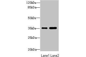 Western blot All lanes: TOB2 antibody at 1. (TOB2 抗体  (AA 1-70))